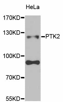FAK / Focal Adhesion Kinase Antibody
