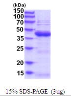 Human UBLCP1 Protein (Recombinant His)