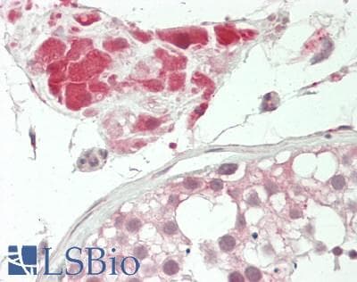 IHC-plus™ Polyclonal Rabbit anti-Human TUSC3 Antibody (Internal, IHC, IF, WB)