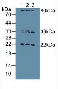 DUSP3 / VHR Antibody (aa2-185)