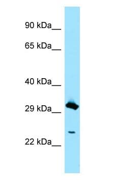 Polyclonal Rabbit anti-Human CLEC4D / MCL Antibody (aa134-183, WB)
