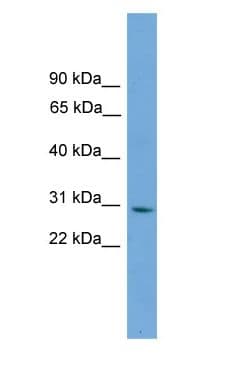 TNRC5 / CNPY3 Antibody (C-Terminus)