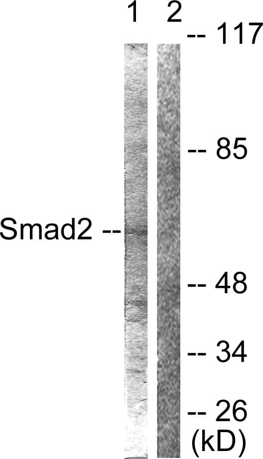 IHC-plus™ Polyclonal Rabbit anti-Human SMAD2 Antibody (aa418-467, IHC, IF, WB)