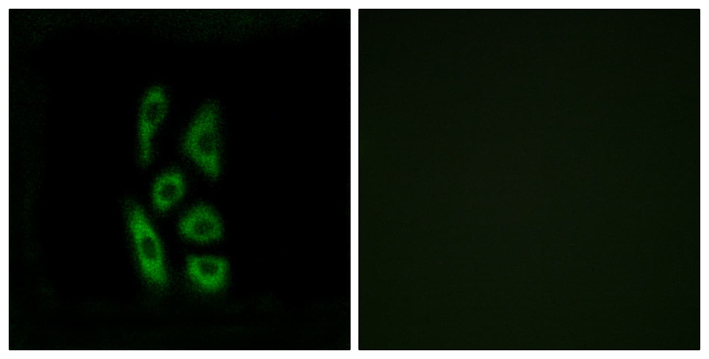 ACOT12 Antibody (aa281-330)