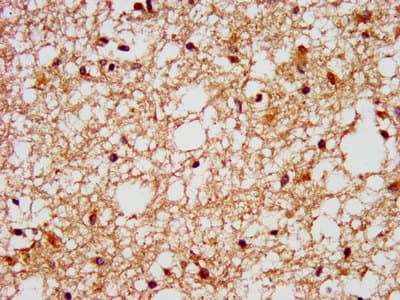 FFAR1 / GPR40 Antibody