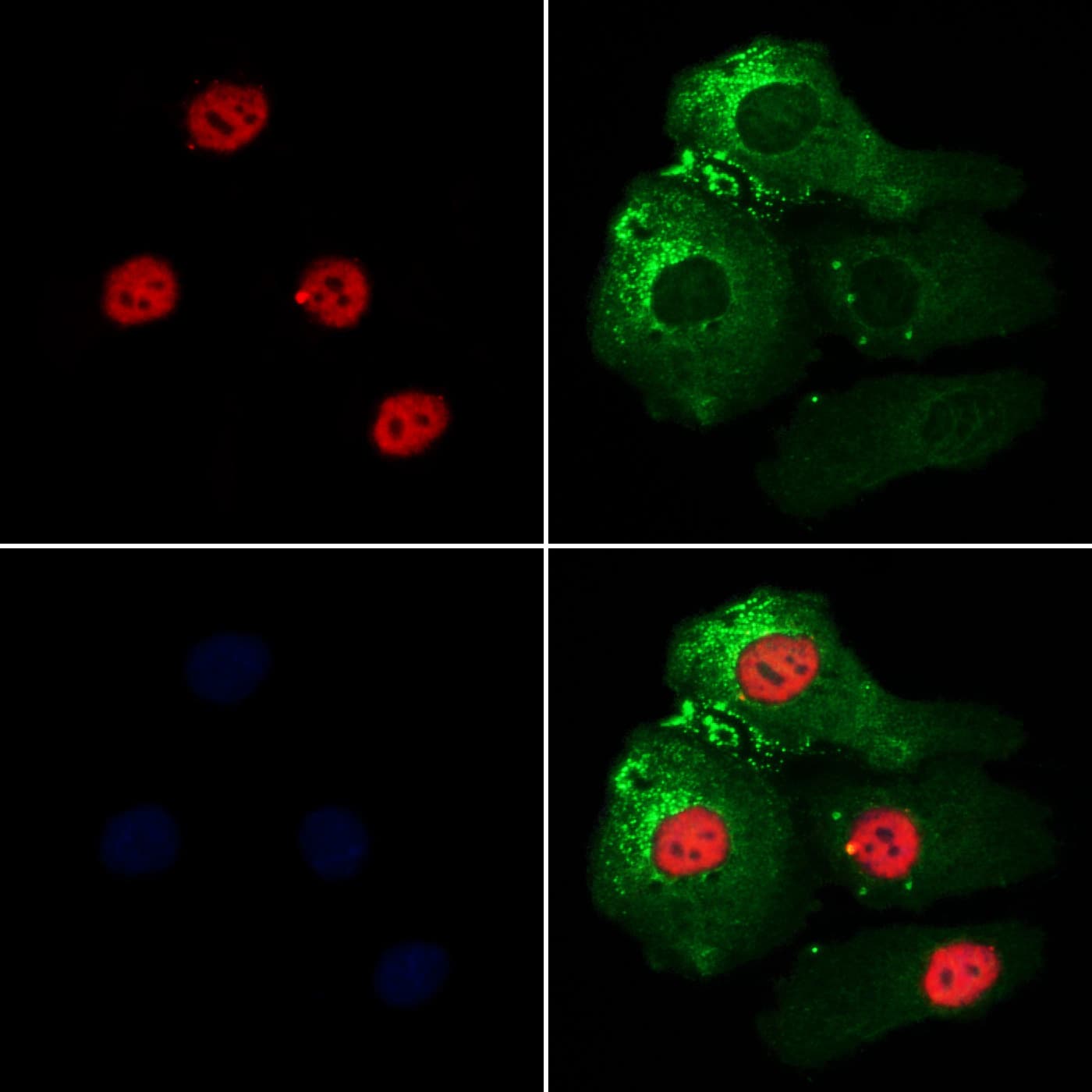Polyclonal Rabbit anti-Human SARNP / Hcc-1 / CIP29 Antibody (IF, WB)