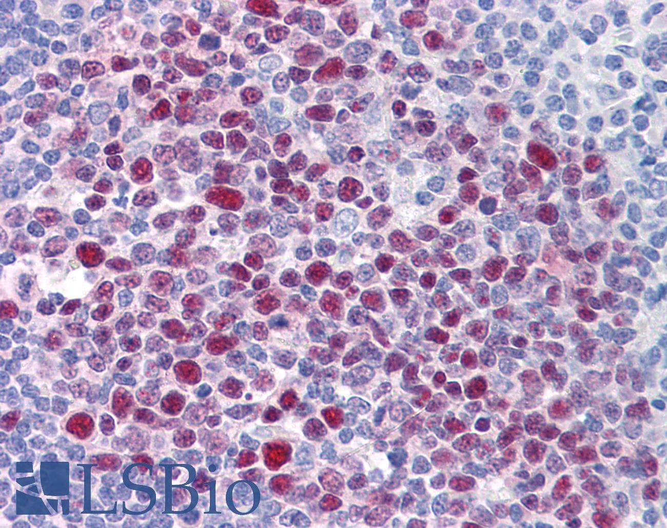 IHC-plus™ Monoclonal Mouse anti-Human EPSTI1 Antibody (clone 2A8, IHC, WB)