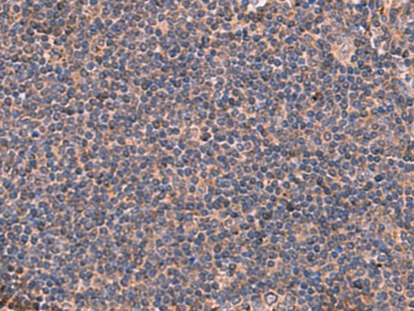 Polyclonal Rabbit anti-Human ITGA11 / Integrin Alpha 11 Antibody (IHC)