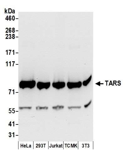 TARS Antibody (aa673-723)