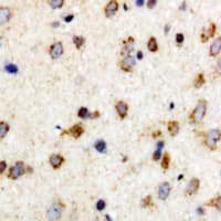 Polyclonal Rabbit anti-Human FER Antibody (phospho-Tyr402, IHC, WB)