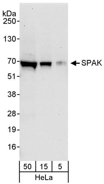 Polyclonal Rabbit anti-Human STK39 / SPAK Antibody (aa425-450, IHC, WB)