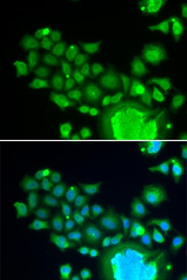 Polyclonal Rabbit anti-Human FZR1 Antibody (IHC, IF, WB)