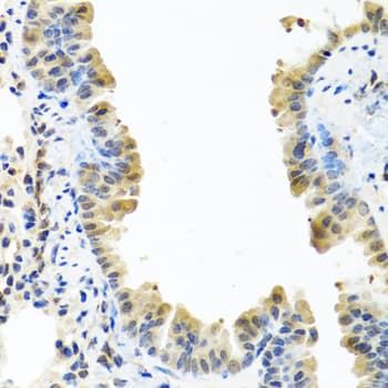 ARSF / Arylsulfatase F Antibody