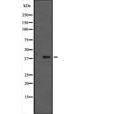 Polyclonal Rabbit anti-Human MAPK13 / p38delta Antibody (WB)