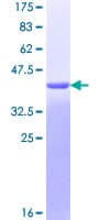 Human PYCARD / ASC / TMS1 Protein (Recombinant GST)