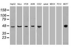 KRT18 / CK18 / Cytokeratin 18 Antibody (clone OTI1E1)