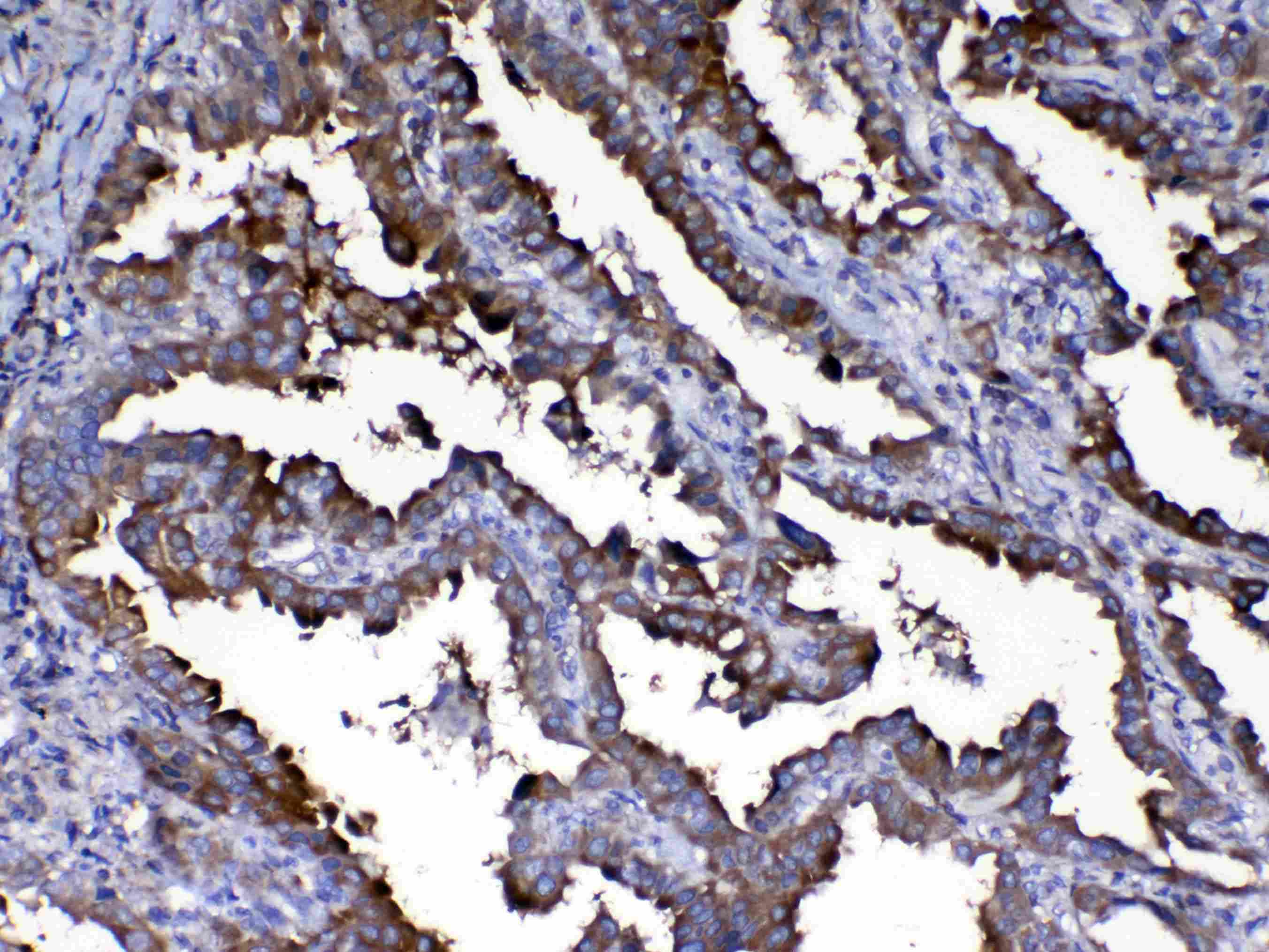 CAPN2 / Calpain 2 / M-Calpain Antibody