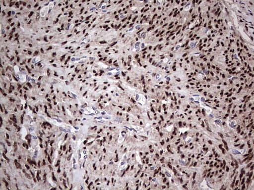 Monoclonal Mouse anti-Human PR / Progesterone Receptor Antibody (clone OTI31D9, aa1-298, IHC)