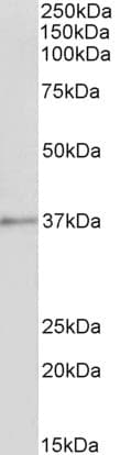 IHC-plus™ ANXA1 / Annexin A1 Antibody (aa324-337)
