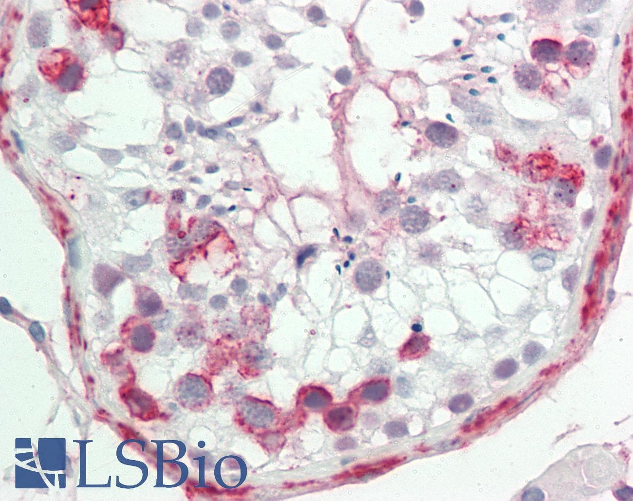PathPlus™ Polyclonal Rabbit anti-Human APCS / Serum Amyloid P / SAP Antibody (IHC, WB)