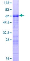 Human ARPC1B / p41-ARC / ARP2 Protein (Recombinant GST)