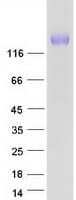 Human PLB1 Protein (Recombinant Myc-DDK (Flag))