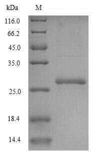Mouse CMPK / CMPK1 Protein (Recombinant 6His, N-terminus)