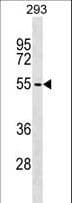 ZBTB6 Antibody (aa391-420)