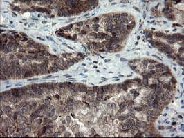 SKIL / SNO / SnoN Antibody (clone OTI3F6)