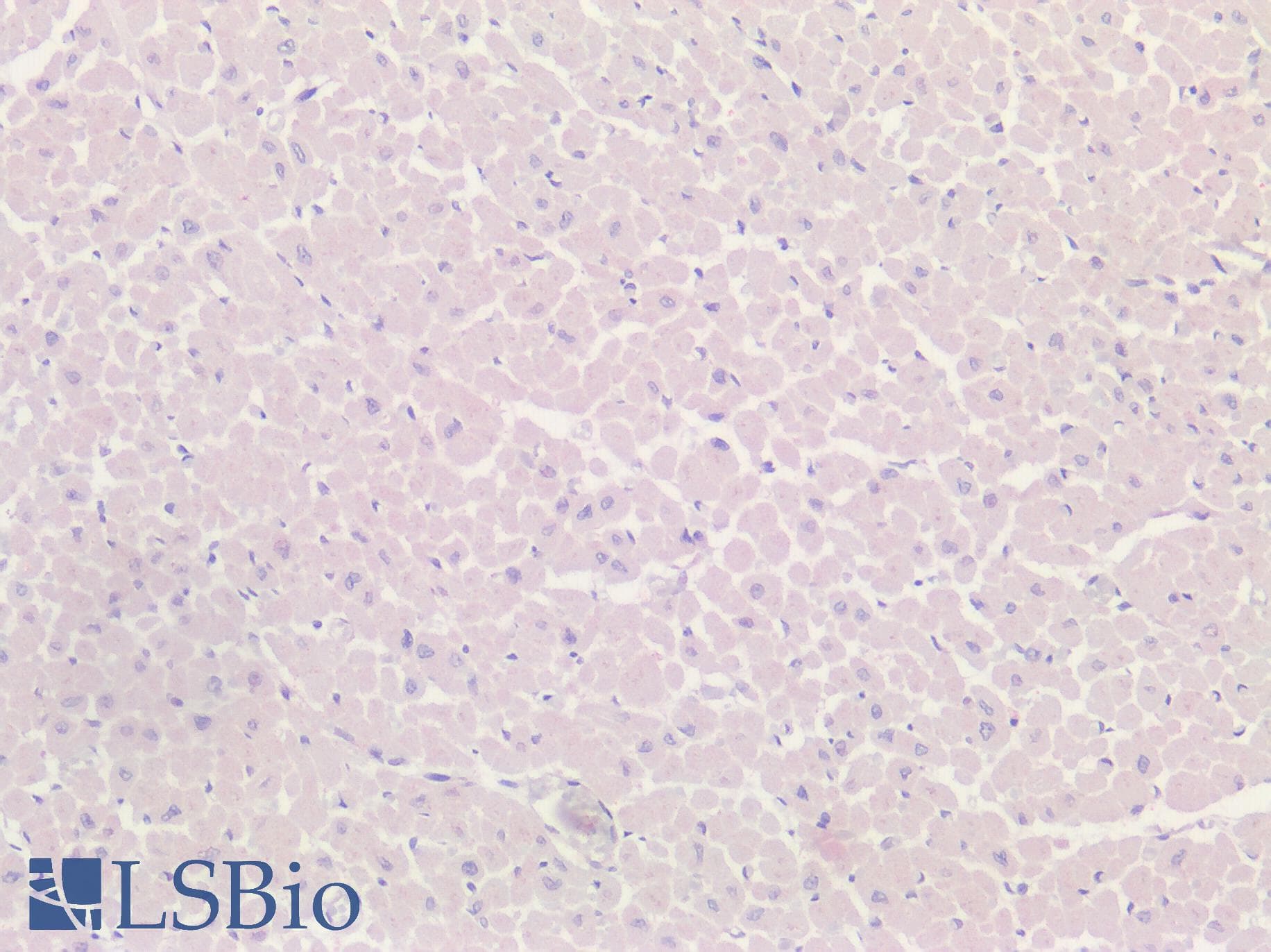 IHC-plus™ GPRC5D Antibody (Cytoplasmic Domain)