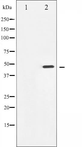Polyclonal Rabbit anti-Human AURKA / Aurora-A Antibody (phospho-Thr288, IHC, IF, WB)