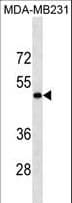 LOX / Lysyl Oxidase Antibody (aa234-260)