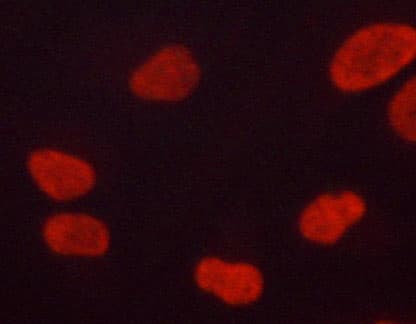 MAPK3 / ERK1 Antibody (phospho-Tyr204,pThr202)