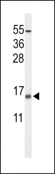 IHC-plus™ KCNE5 Antibody (aa67-96)