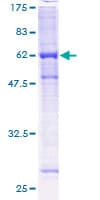 Human PHF9 / FANCL Protein (Recombinant GST)