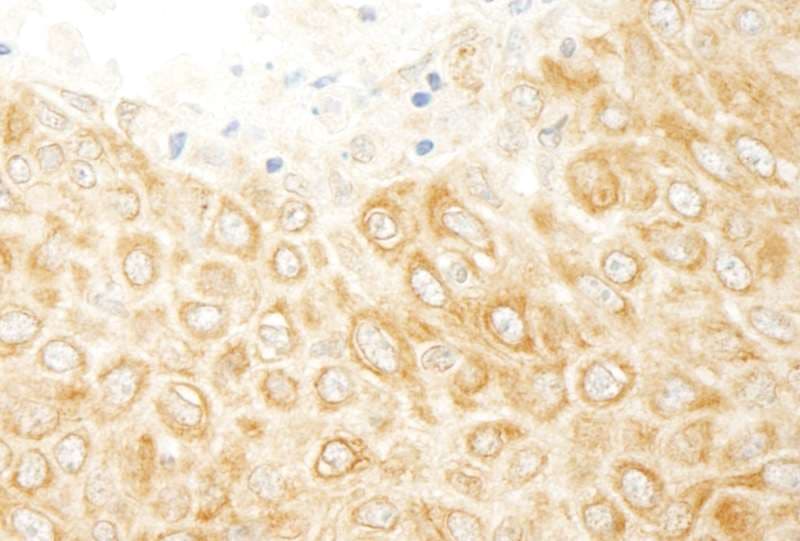 ZAK / MLTK Antibody (aa750-800)