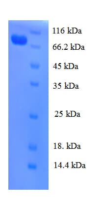 Human CDC23 Protein (Recombinant His)