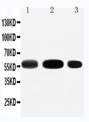 Polyclonal Rabbit anti-Mouse SLC1A1 / EAAT3 Antibody (aa10-27, WB)