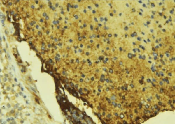 F10 / Factor X Antibody