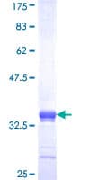 Human MEX3D Protein (Recombinant GST, N-terminus)