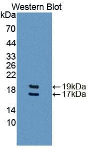 FABP4 / AP2 Antibody (aa2-132)