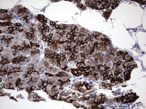 Monoclonal Rat anti-Human Acidic Cytokeratin Antibody (clone 9H3, IHC)