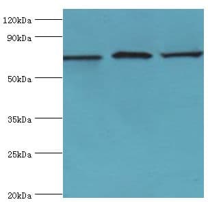 Polyclonal Rabbit anti-Human SLC25A13 / CITRIN Antibody (aa1-300, WB)