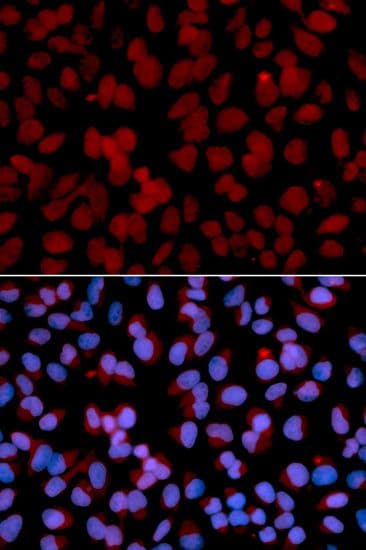 TNFAIP3 / A20 Antibody