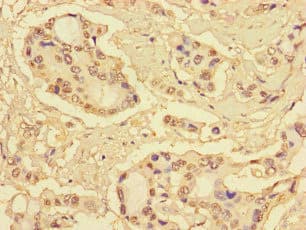 S100P Antibody