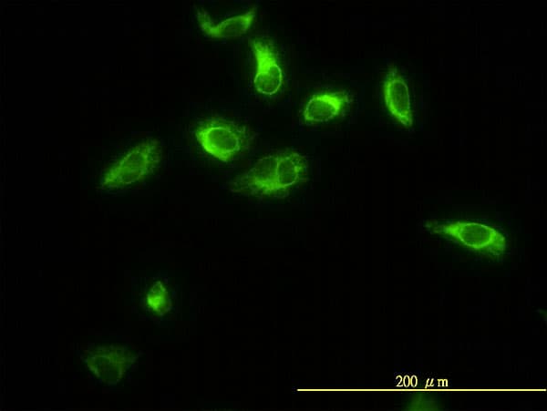 TPMT Antibody (clone 1B5)