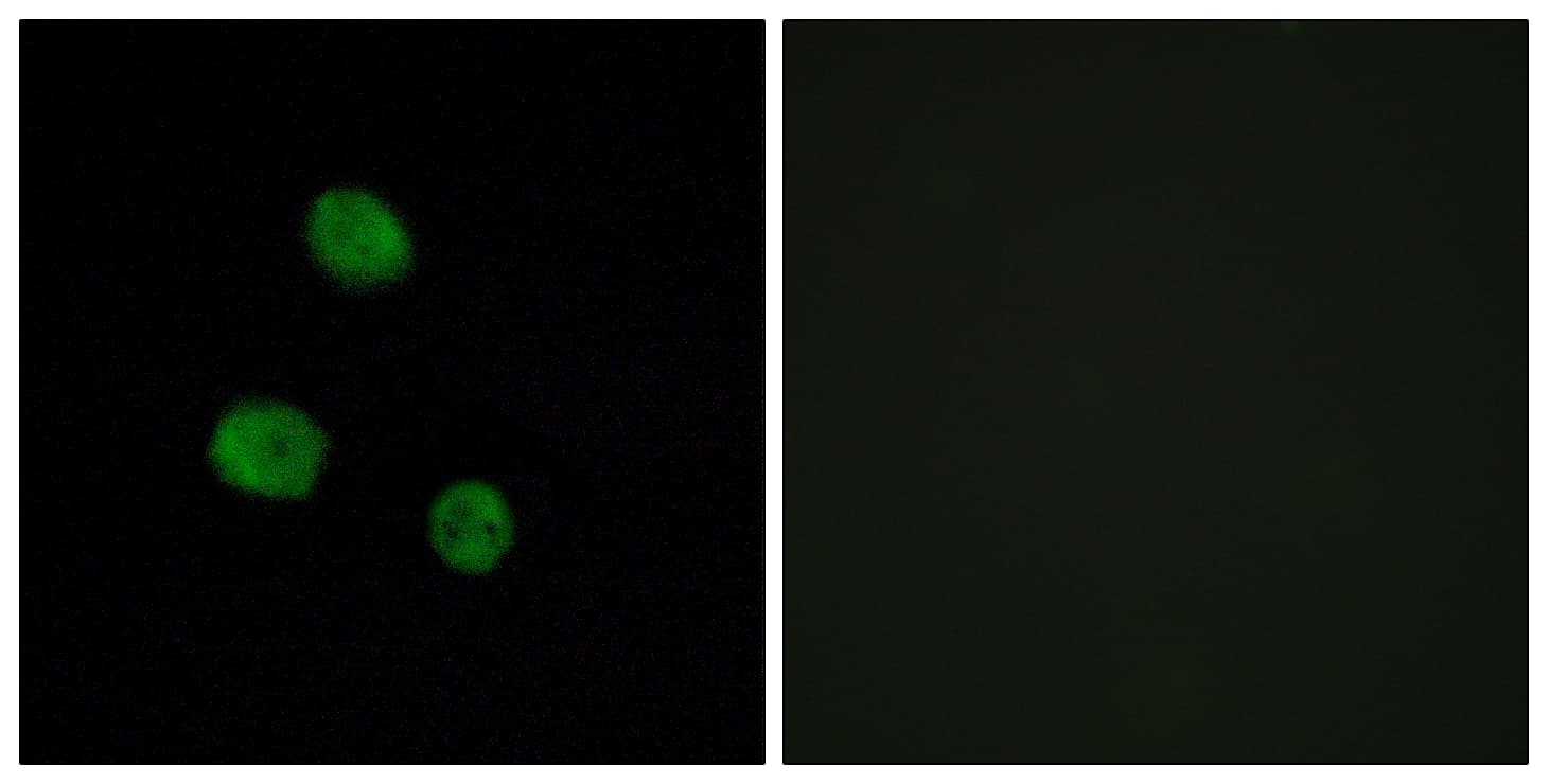HNRPM / HNRNPM Antibody (aa11-60)