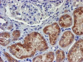 UNG / Uracil DNA Glycosylase Antibody (clone OTI1F8)