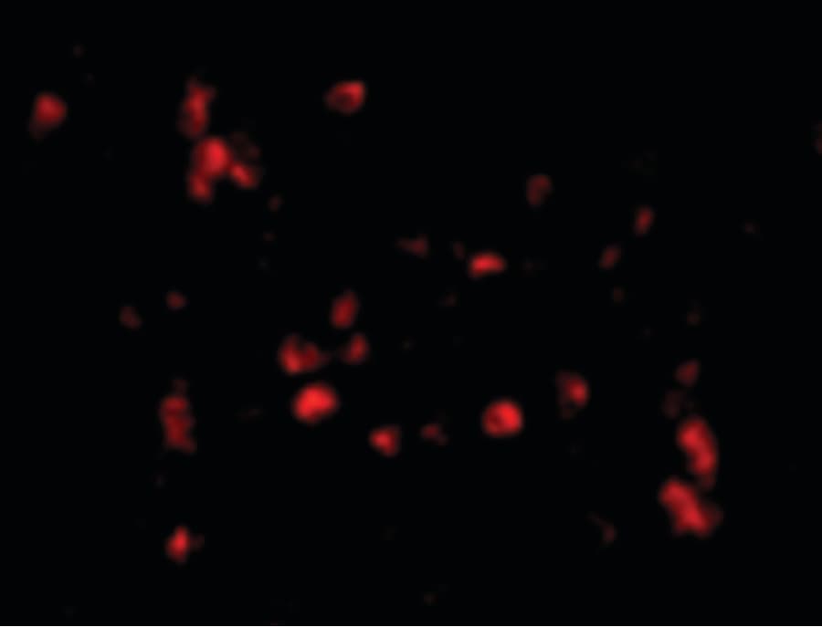 IHC-plus™ LL37 / Cathelicidin Antibody
