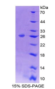 Mouse BCL9 Protein (Recombinant His-T7)